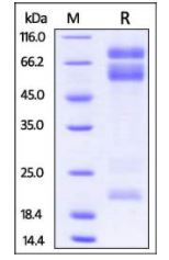Mouse ADAM17, His Tag on SDS-PAGE under reducing (R) condition. The gel was stained overnight with Coomassie Blue. The purity of the protein is greater than 85%.